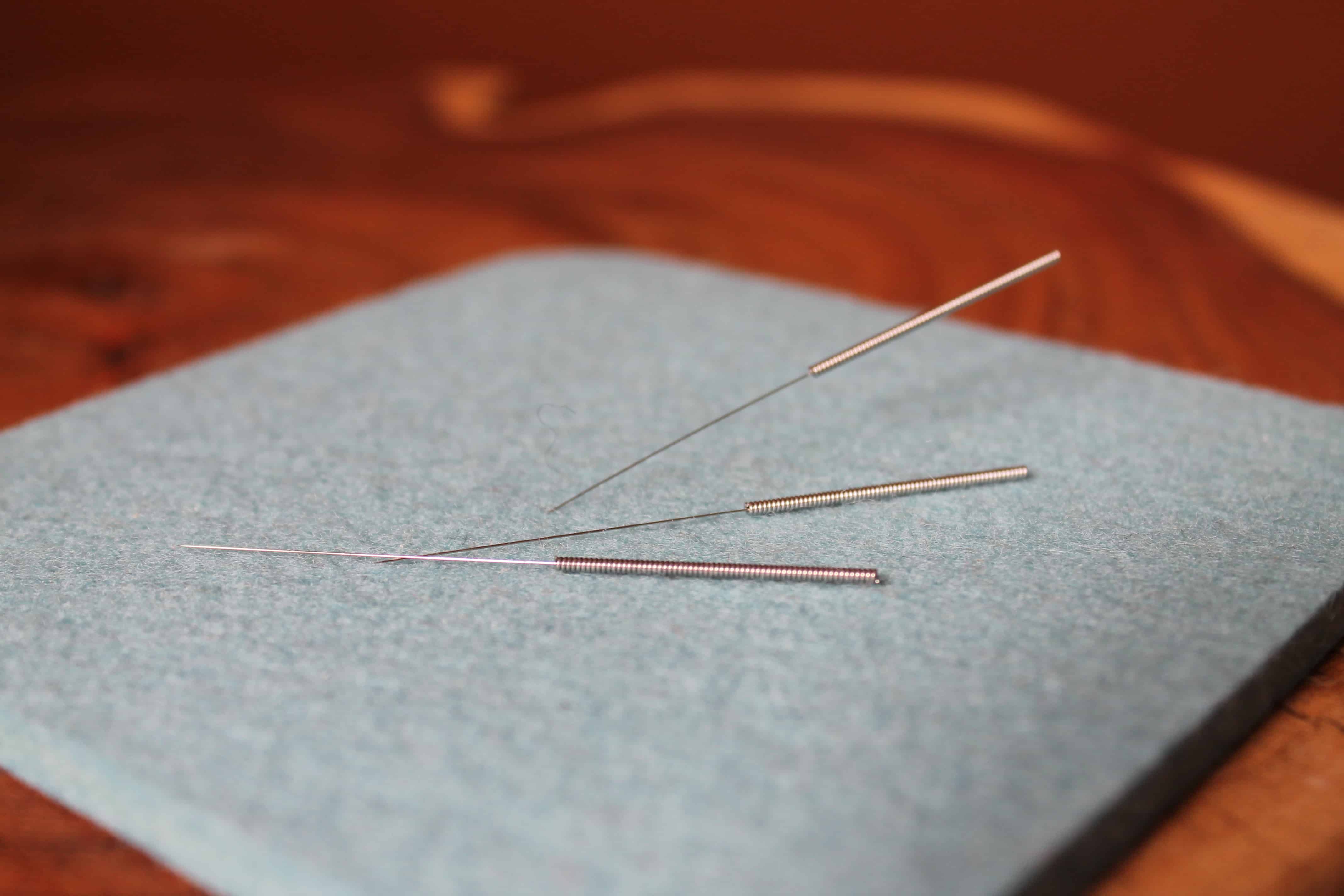 Blog Series Part 1 How Acupuncture Improves Fertility
